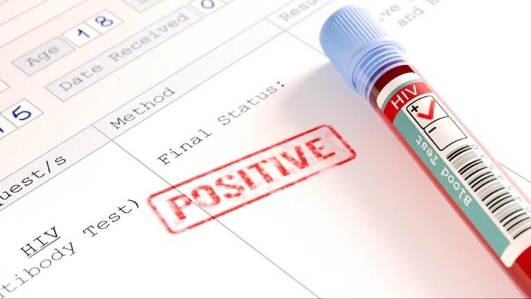 hiv